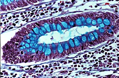 osservazioni microscopia ottica Sintak