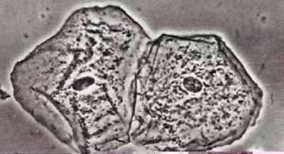 osservazioni microscopia ottica Sintak