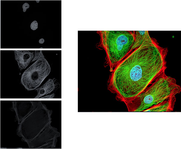 immagini telecamera microscopio