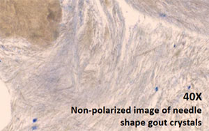 NED-DP luce polarizzata