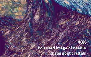 NED-DP luce polarizzata