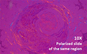 NED-DP luce polarizzata